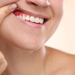 early signs of gum disease and prevention
