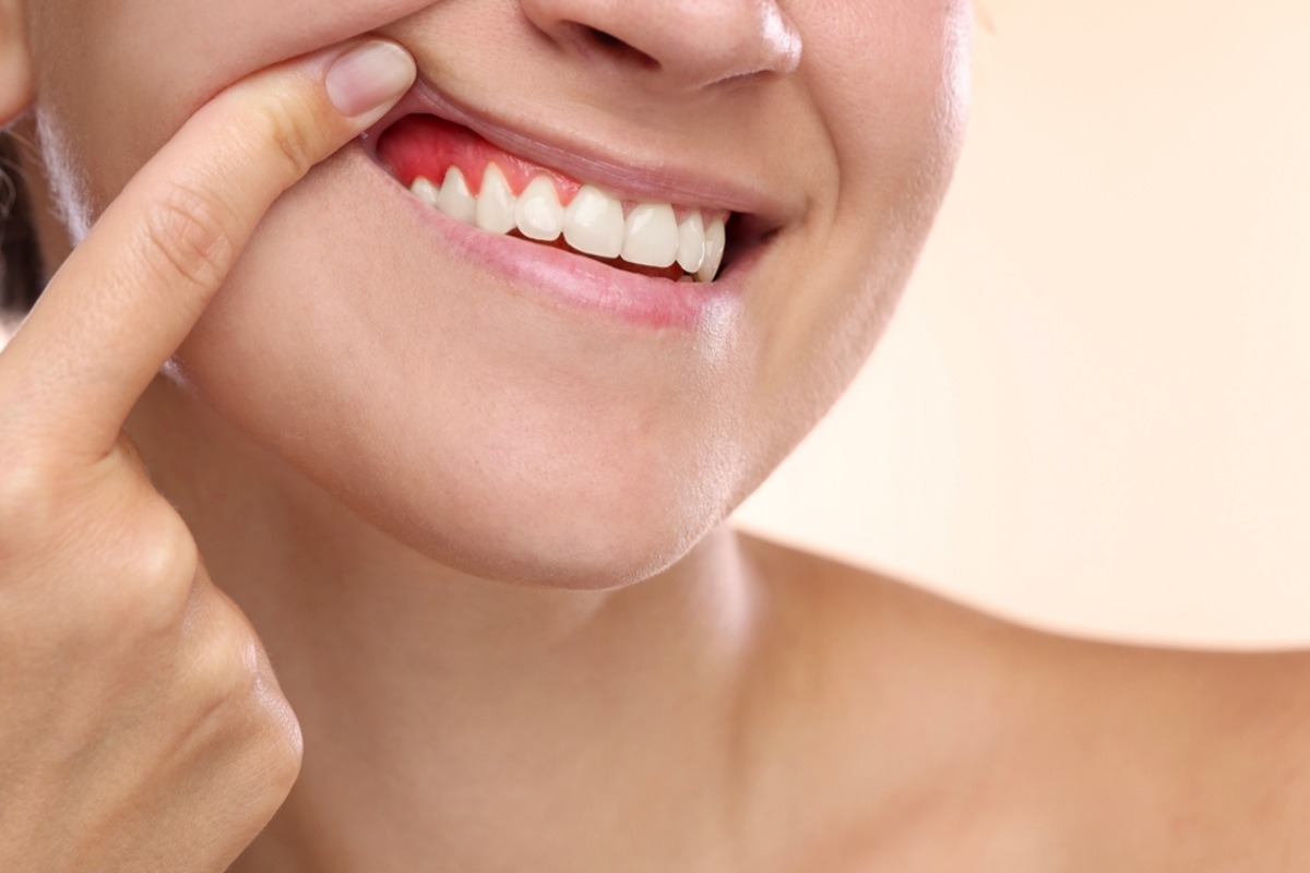 early signs of gum disease and prevention