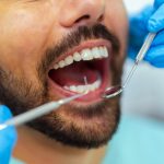 oral surgery