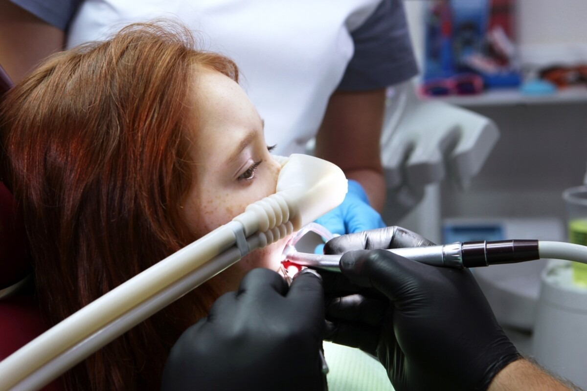 nitrous sedation