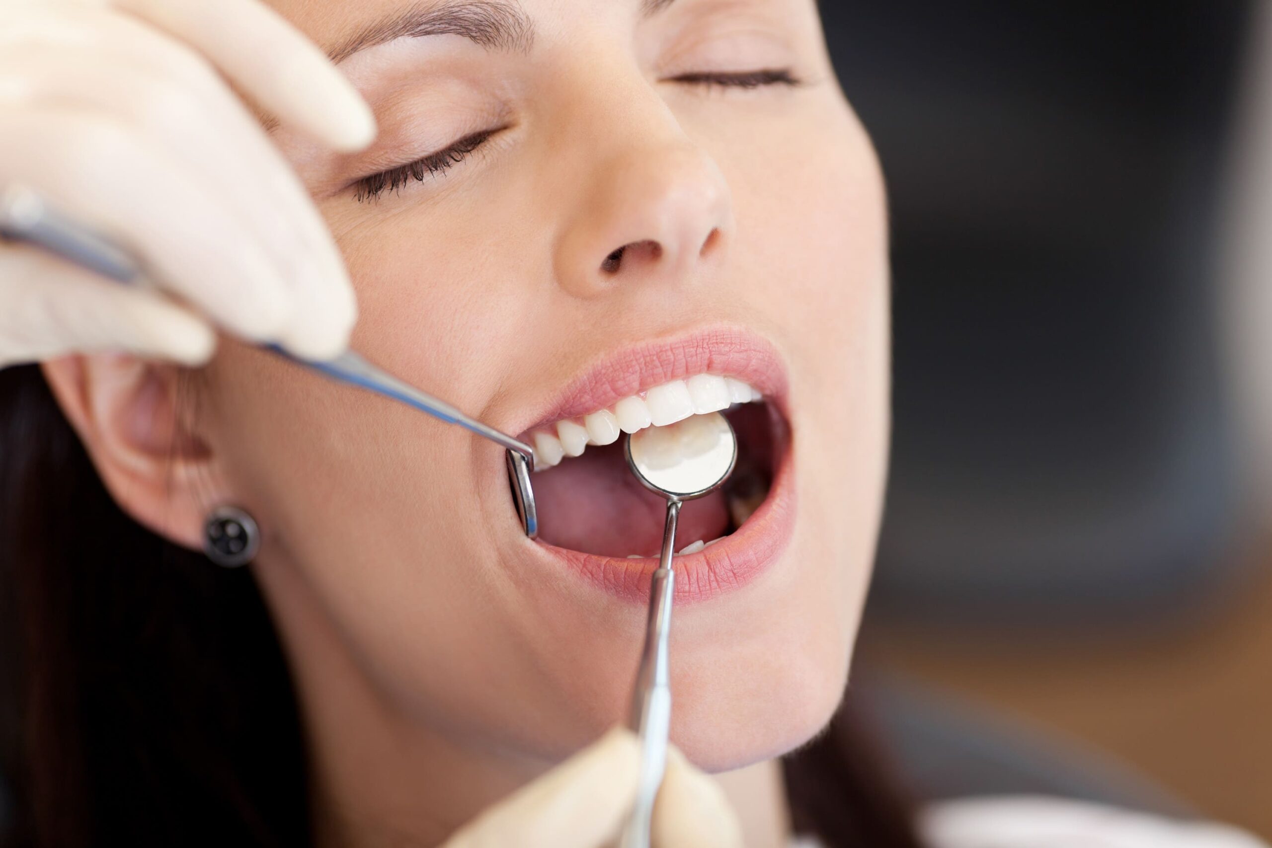 everything you need to know about sedation dentistry