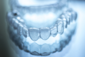 How-Much-Does-the-Invisalign-Cost
