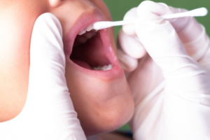 Why is Fluoride Treatment recommended for Adults after Dental Cleaning