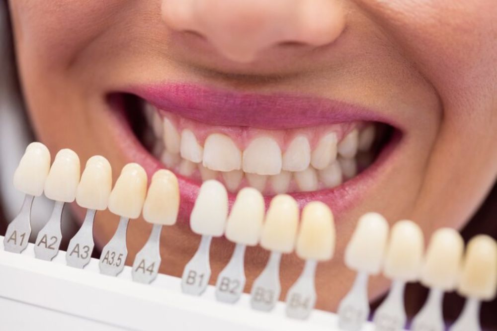 Dentist showing crowns to a lady
