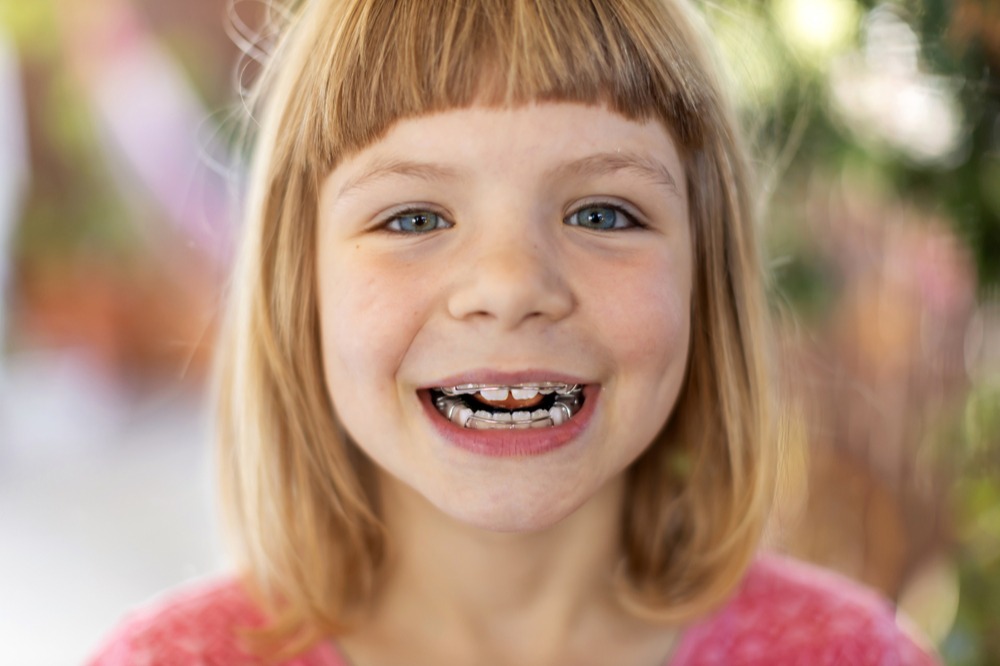 what is the best age for kids to get braces